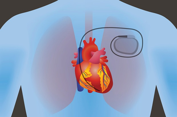 First-degree block: Most likely does not require any treatment 
Second-degree block: You may need a pacemaker implanted
Third