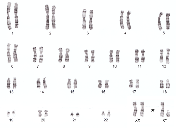 The dark bands around the chromosomes are caused richness in adenine and thymine.