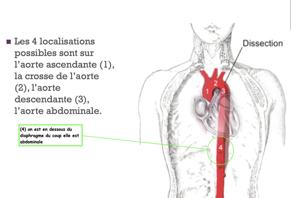 Localisations anatomiques