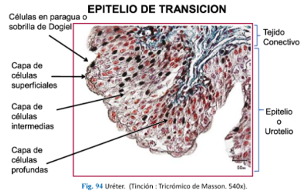 LLANOS , J. ; ZILVETTY , E. (2019)               Epitelio de transición