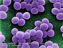 Representative Specie:
- Staphylococcus Aureus