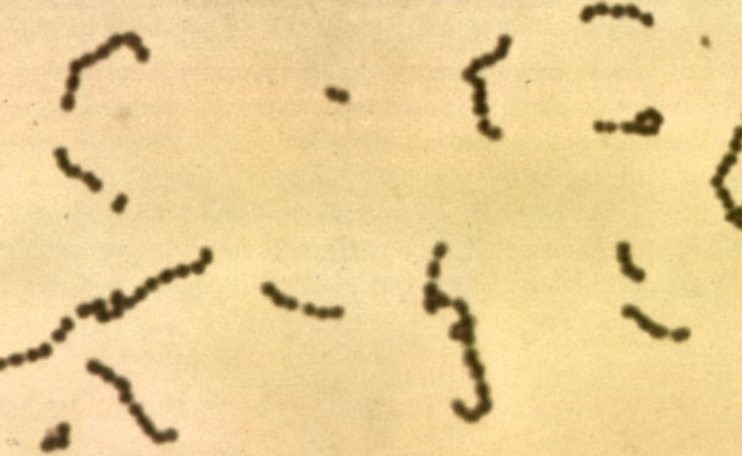 Streptococci are gram-positive aerobic; pneumonia