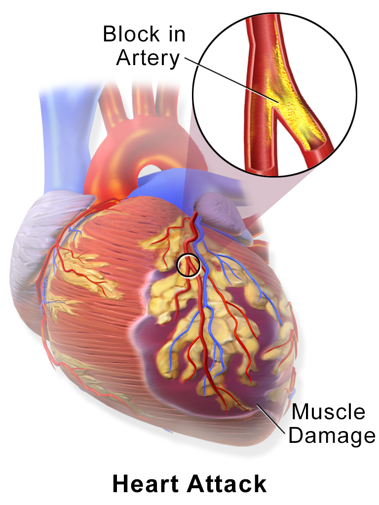 Strengthens the heart and reduce risk of
cholesterol, heart attack