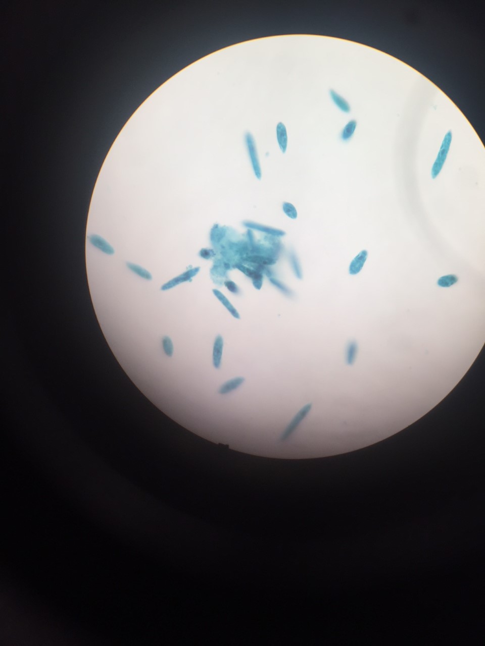 Picture of a euglena that was taken in class witht he help of a mictoscope.