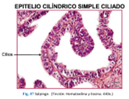 LLANOS , J. ; ZILVETTY , E. (2019) epitelio cilíndrico ciliado  tiene en sus borde apical cilios. se encuentra en