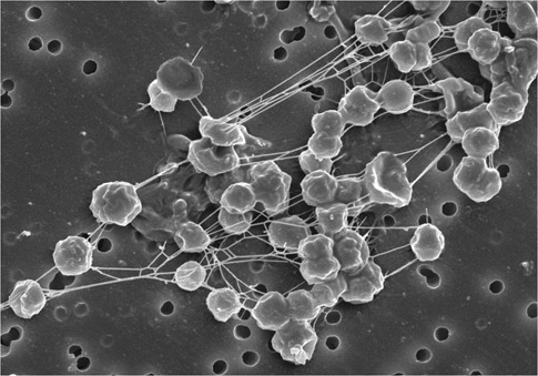 Methanogens