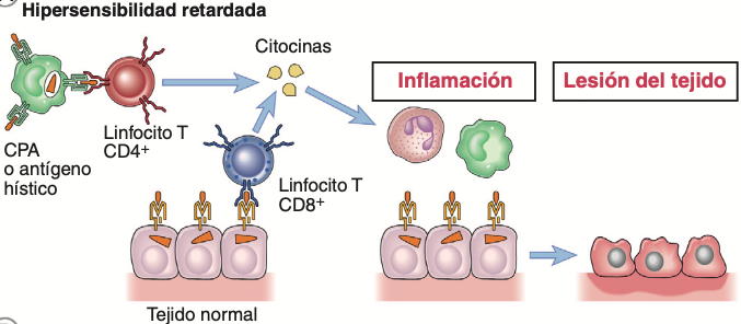 En las reacciones de hipersensibilidad retardada, los linfocitos T CD4+ (y a veces los CD8+) responden a los antígenos hístic