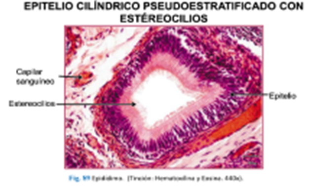 LLANOS , J. ; ZILVETTY , E. (2019) Epitelio cilíndrico pseudoestratificado no ciliado con este'reocilios