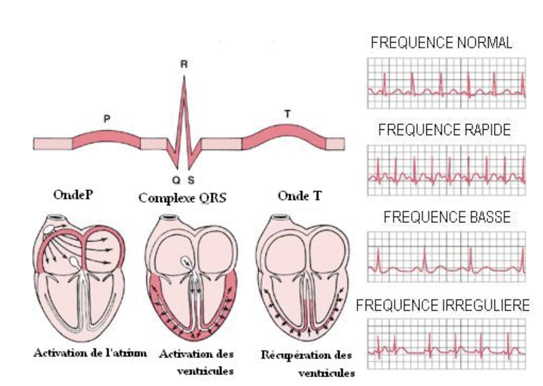 ECG image