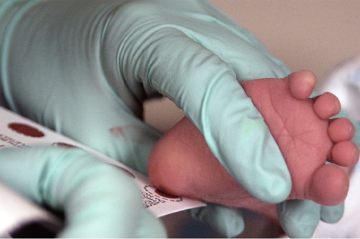 Newborn Screening