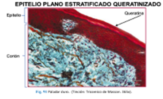 LLANOS , J. ; ZILVETTY , E. (2019)  Epitelio plano estratificado queratinizado (seco)