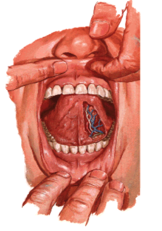 El frenillo de lengua es una cuerda de membrana    mucosa que va de la mitad de la cara inferior de la lengua (cara sublingua