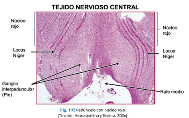 LLANOS , J. ; ZILVETTY , E. (2019)