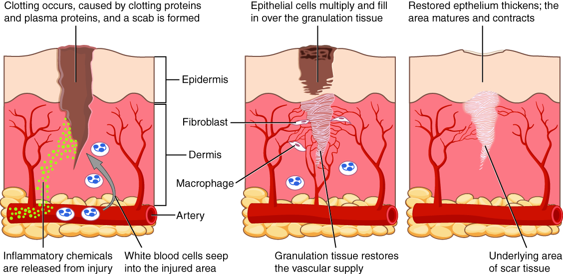 REPAIRING SKIN TISSUE