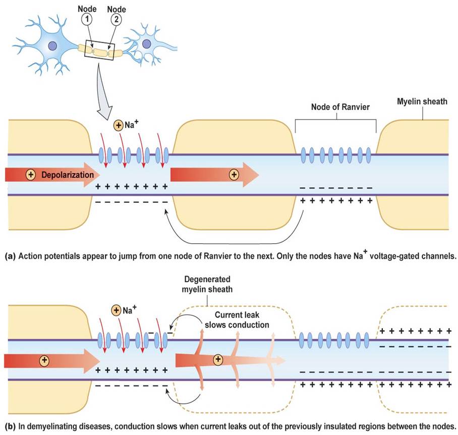 DEMYELINATING DISEASES AFFECT CONDUCTION VELOCITY