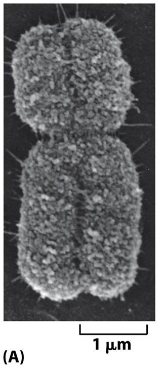 Human chromosomes showing the centromeres and well-defined chromatids