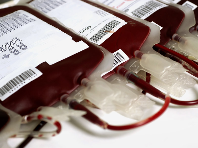 Blood Transfusions