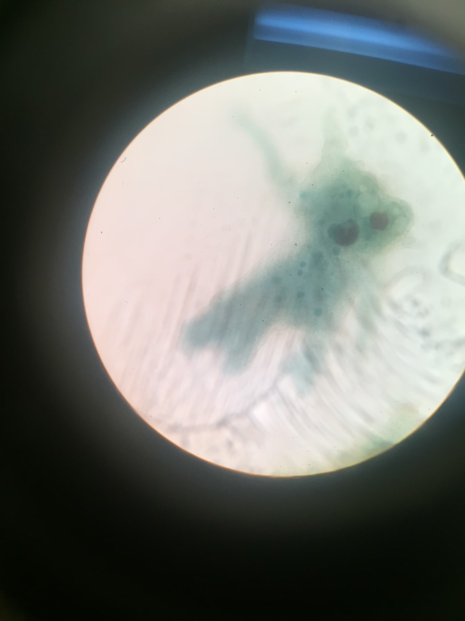 Picture of an amoeba that was taken in class with the use of a microscope.