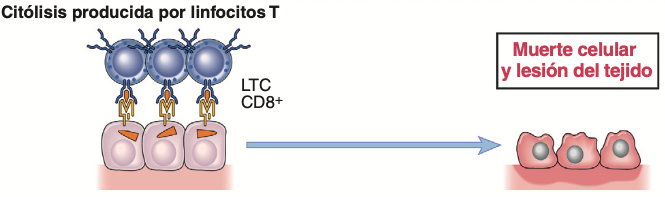 En algunas enfermedades, los linfocitos T CD8+ destruyen directamente las células del tejido.