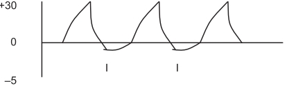 Ventilación asistido/ controlado