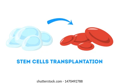 Stem Cell Transplant