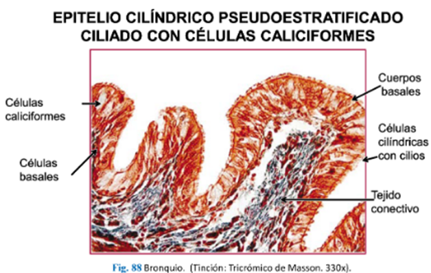 LLANOS , J. ; ZILVETTY , E. (2019)          Epitelio cilíndrico pseudoestratificado ciliao con ce'lulas calciformes