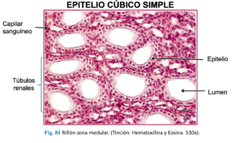 LLANOS , J. ; ZILVETTY , E. (2019)   Epitelio cúbico simple