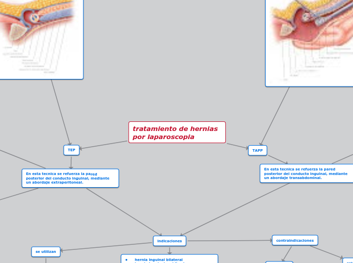 tratamiento de hernias por laparoscopia - Mapa Mental