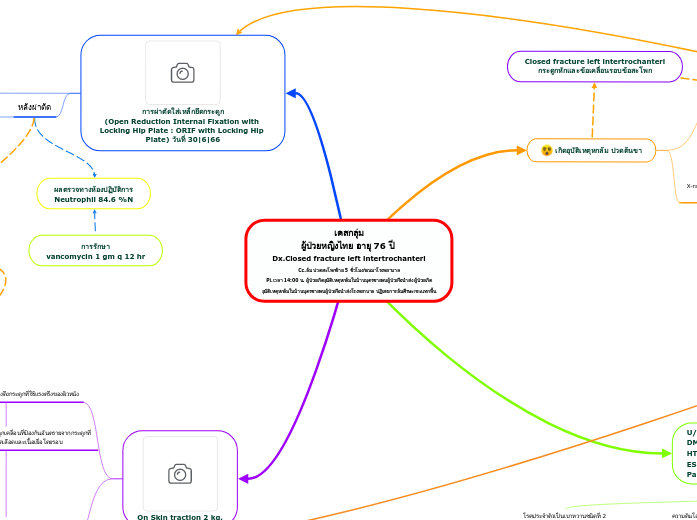 เคสกลุ่ม
ผู้ป่วยหญิงไทย อายุ 76 ปี 
Dx.Clo...- Mind Map