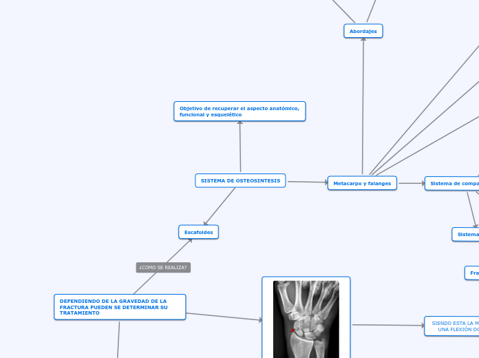 SISTEMA DE OSTEOSINTESIS