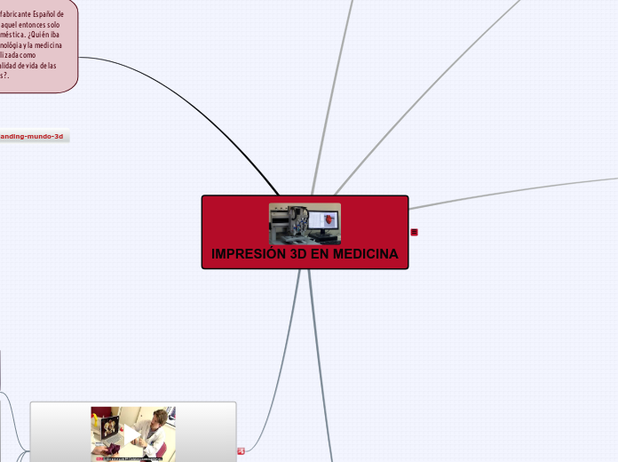 IMPRESIÓN 3D EN MEDICINA - Mapa Mental