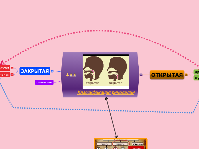 Классификация ринолалии - Мыслительная карта