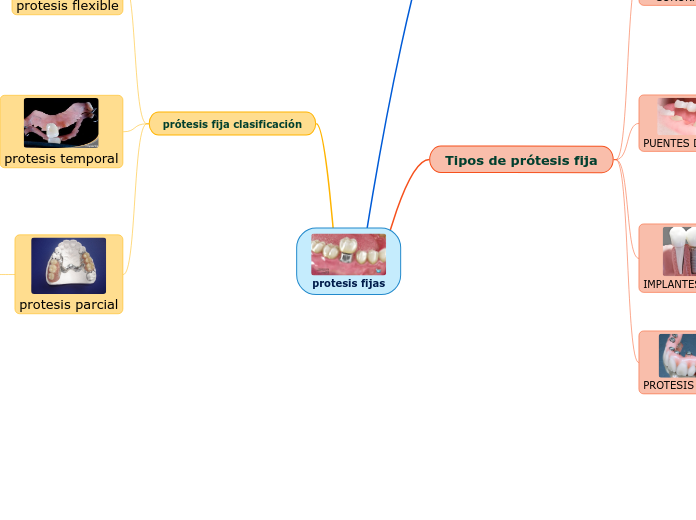 protesis fijas