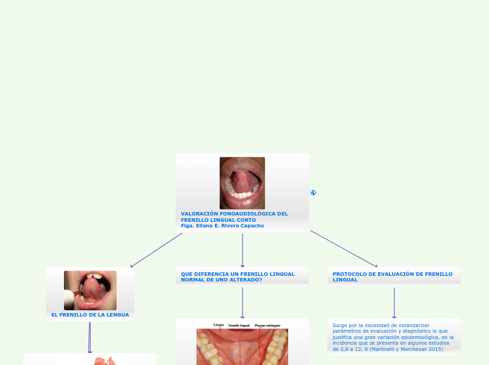 VALORACIÓN FONOAUDIOLÓGICA DEL FRENILLO LINGUAL CORTO
