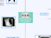Extirpación de pulmón    Neumonectomía - Mapa Mental