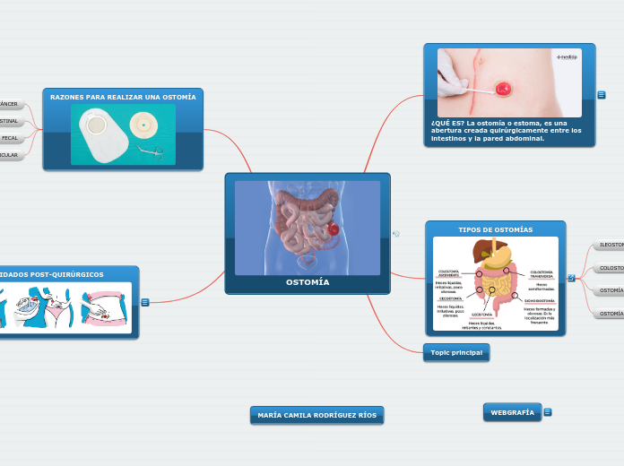 OSTOMÍA